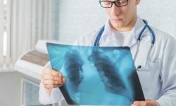 Смертность от туберкулеза снизилась почти в 4 раза