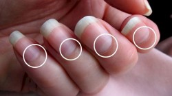 ​Лунки на ногтях и их значение для здоровья