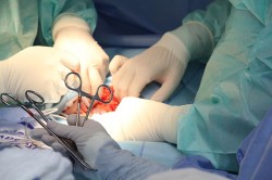 Первую в мире трансплантацию легких и печени от живых доноров провели в Японии