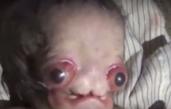 В Индии умер младенец инопланетянин