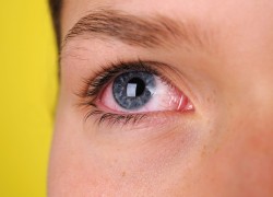 Медики назвали серьёзные недуги, о которых сигнализируют красные глаза