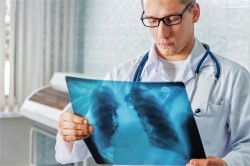 Как российские врачи и ученые противостоят туберкулезу